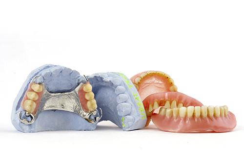 Dentures and lab molds